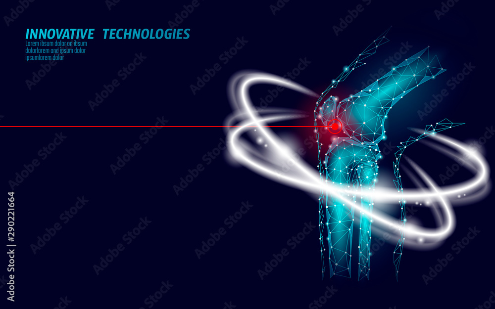 Human knee joint 3d model vector illustration. Low poly design future technology cure pain treatment. Blue background and red injury man body leg medicine template - obrazy, fototapety, plakaty 