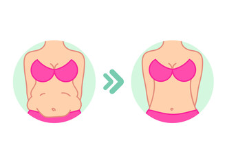 Wall Mural - Fat on belly. Tummy before and after diet, fitness or liposuction. Vector illustration of woman belly.