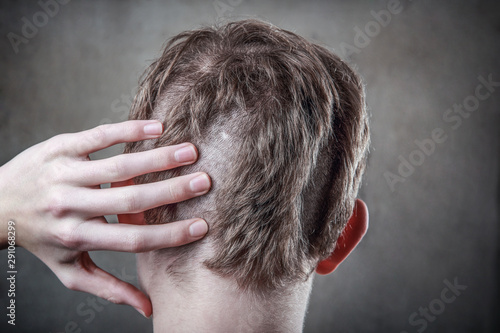 Teen With A Bad Haircut Back View Buy This Stock Photo And