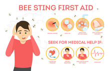Bee Sting First Aid Infographic. Remove Sting From The Skin