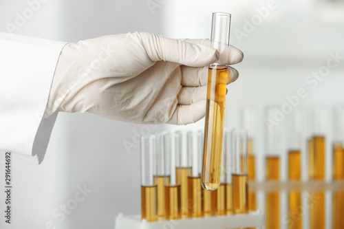Cuadros en Lienzo Doctor holding test tube with urine sample for hemp analysis in laboratory, clos