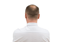 Human Alopecia Or Hair Loss - Adult Men Bald Head. Back Of Balding Man From Shoulders Isolated On White Background