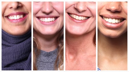 Sticker - Group of four Multiracial women together 