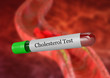 Blood sample in test tube for laboratory cholesterol test.
