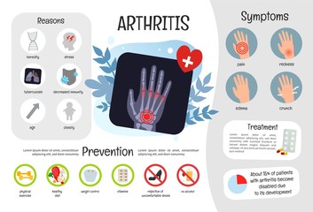 Vector medical poster arthritis. Symptoms of the disease. Prevention. X-ray of the hands.