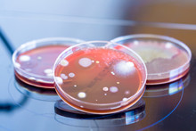 Petri Dishes With Colonies Of Microorganisms In A Biological Laboratory