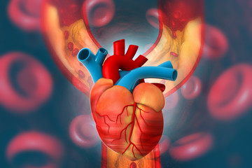 Wall Mural - Cholesterol plaque in artery with Human heart anatomy. 3d illustration