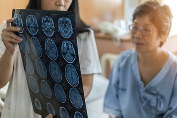brain disease diagnosis with medical doctor diagnosing elderly ageing patient neurodegenerative illn