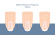 © iv_design - Different Shapes of Fingernail Cuticles. Manicure Guide. Vector illustration
