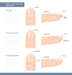 Different Types of Nail Plate. Normal, Convex and Concave Nails. Nail Extension Guide. Vector Illustration