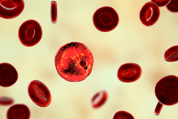 Canvas Print - The malaria-infected red blood cell. 3D illustration showing parasite Plasmodium malariae in the stage of ring-form trophozoite