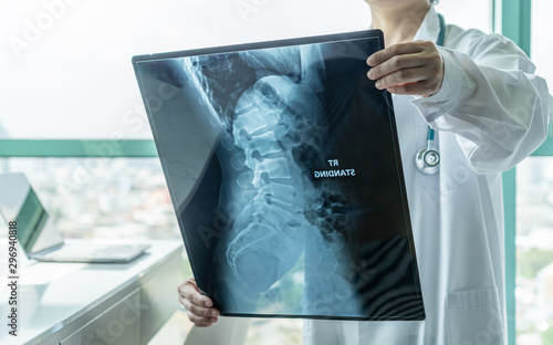 Cuadros en Lienzo Surgical doctor looking at radiological spinal x-ray film for medical diagnosis