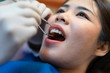 © pic for you - Dentist holding a dental tool of patients in the clinic.Woman lying on the dental chair for dentist checkup.