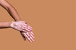 Women's hands with the disease vitiligo close-up on a beige background