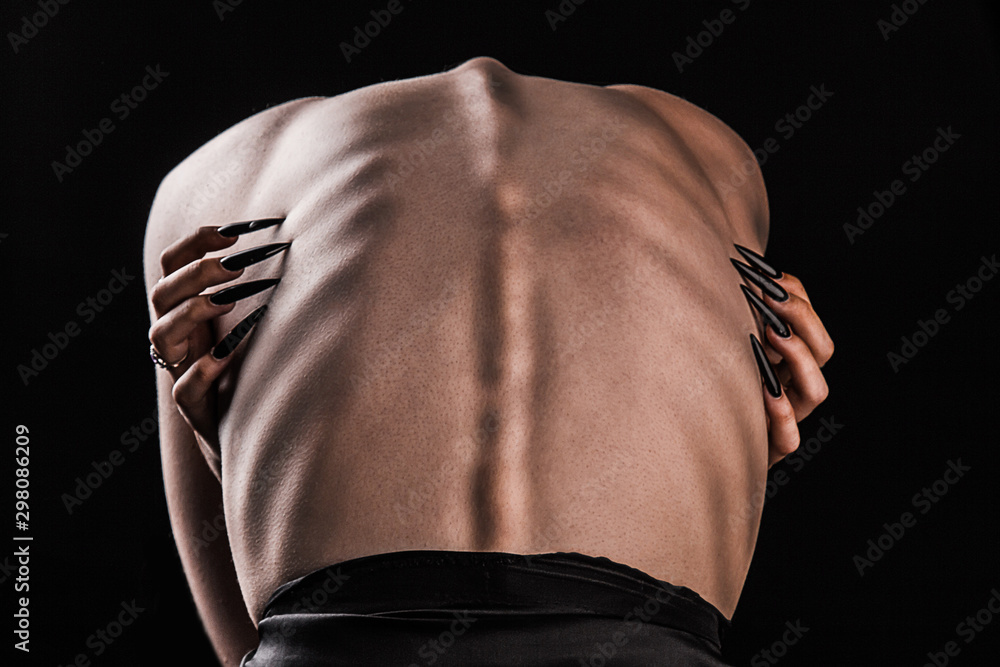 Photo Stock A girl with a bare back, severe thinness and protruding ...