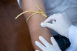 © sap - Doctor hand preparing to injecting  patient in the clinic