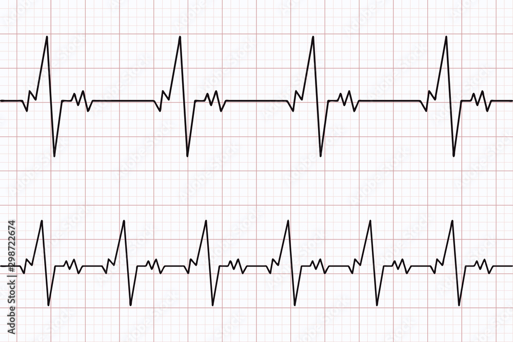 Heartbeats cardiogram. ECG heart line. Electrocardiogram paper ...