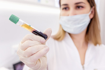 Wall Mural - ?oung attractive doctor with mask on face in scrub and gloves holds in hand test tube with the separated plasma from the patient's blood
