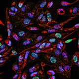 Fototapeta Uliczki - Fluorescent Imaging immunofluorescence of cancer cells growing in 2D with nuclei in blue, cytoplasm in red and DNA damage foci in green