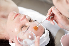 Facial Peeling, Skin Treatment. A Dermatologist Applies Of Phytic Acid With A White Fan Brush On Female Face. A Caucasian Woman In Cosmetic Clinic. Cosmetology, Facial Skin Care. Girl In Beauty Salon