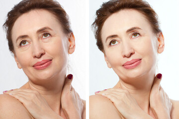 Wall Mural - Close up before after Beauty middle age woman face portrait. Spa and anti aging concept Isolated on white background. Plastic surgery and collagen face injections. Wrinkles and menopause. Beauty