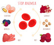 Stop anemia concept. Infographics on the topic of diet with low hemoglobin. Products that help cure and prevent anemia. Vector illustration on the theme of health in cartoon style.