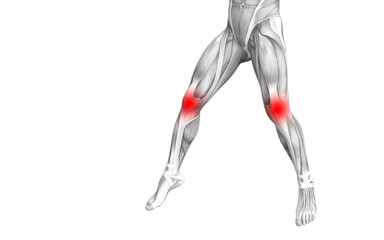 Poster - Conceptual knee human anatomy with red hot spot inflammation or articular joint pain for leg health care therapy or sport muscle concepts. 3D illustration man arthritis or bone osteoporosis disease