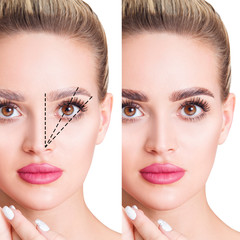 Young woman with dotted lines before and after eyebrows correction.