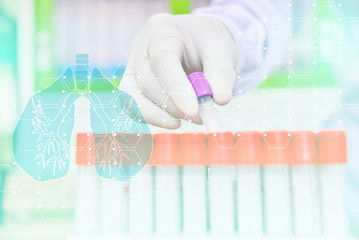 Healthy.science, chemistry, biology, medicine and people concept. close up of doctor holding test tube with blood sample making research in clinical laboratory.Doctor analyzes tubes of blood in a lab.