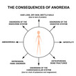 The consequences of anorexia. Slim physique with anorexia. Infographics. Vector illustration on isolated background.