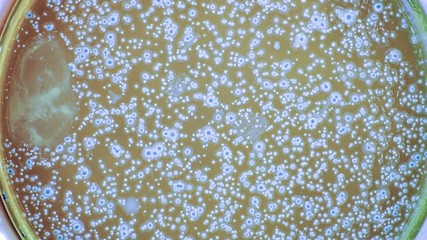 Poster - Growing Bacterial Colonies In Petri Dish, Time Lapse. growth of bacteria taken in a bathroom in a Petri dish