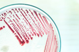 Fototapeta Koty - colony of bacteria in petridish