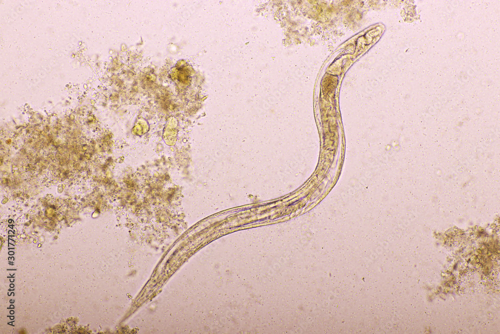 Strongyloides stercoralis or threadworm in human stool, analyze by ...