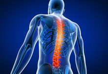3d Rendered Medically Accurate Illustration Of A Man Having A Painful Back
