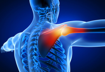 3d rendered medically accurate illustration of a man having a painful shoulder