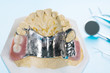 Close up, Removable partial denture (RPD.) on blue background.