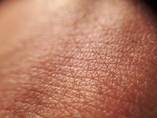 Wall Mural - macro skin of human hand.Medicine and dermatology concept. Details of human skin background.