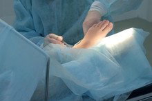 Surgeon Man Making Surgery Of Removal Ankle Hygroma On Leg In Hospital In Operating Room, Hands Closeup. Doctor Using Medical Tools Clamp And Tweezers. Surgical Treatment Of Hygroma.