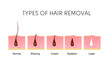 Comparison of the popular methods of hair removal: shaving, cream, epilator, and laser. Anatomy infographics vector illustration.