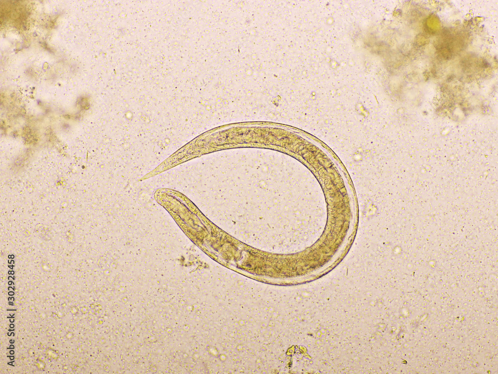 Strongyloides stercoralis or threadworm in human stool, analyze by ...