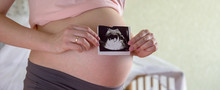 Big Pregnant Tummy And Woman's Hands Holding Ultrasound Image Of Healthy Unborn Baby. Women's Health And People Concept. Maternity Prenatal Care And Woman Pregnancy Concept. Panoramic Banner.