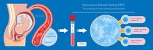 Noninvasive prenatal testing NIPT screening genetic disorders bloodstream cfDNA lab plus diagnostic diagnose 21 18 13 cell free chromosomal abnormalities NIFTY exam simple