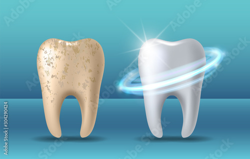 Fotomural Clean and dirty tooth before and after whitening
