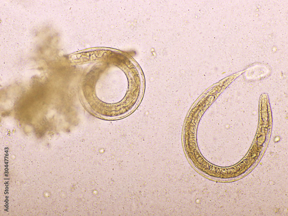 Strongyloides stercoralis or threadworm in human stool, analyze by ...