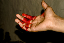 A Badly Bleeding Hand And Dark Background 