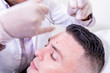 © Joyce Grace - Caucasian man undergoing beauty spa botulinum neurotoxin Botox treatment for anti-aging, to smooth wrinkles as a cometic solution. Injecting forehead to relax muscles with a non-invasive procedure.