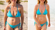 © Kaspars Grinvalds - Before and after weight loss