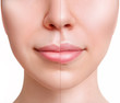 © Galaxy_love_design - Sensual female lips before anf after augmentation procedure.