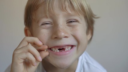 Wall Mural - Little boy shows that some of his milk teeth had fallen out. Concept of tooth change in children