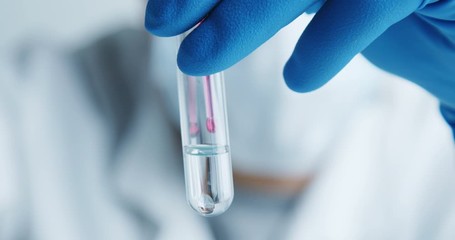 Wall Mural - medical worker of the laboratory carefully examines the serum in a glass tube and shakes it